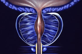 New Data Highlights Potential for Focused Ultrasound in Prostate Cancer Treatment