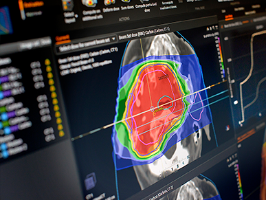 RaySearch to Showcase New Planning Tools for Photon, SRS and Particle Therapy at ASTRO 2024