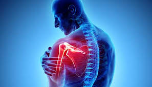 SIR 2022: Image-Guided Technique Regenerates Damaged Nerves for Pain Management