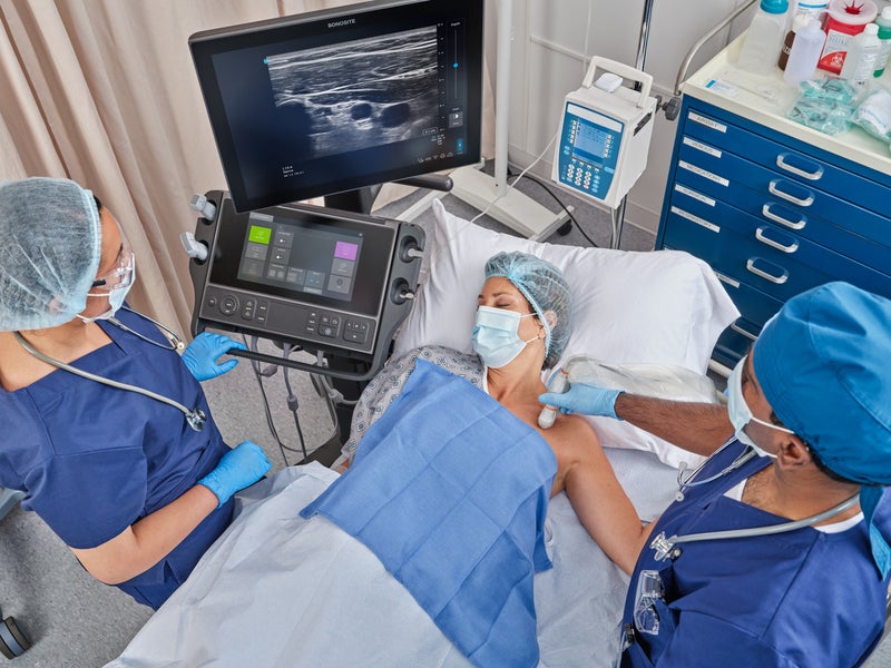 FUJIFILM Sonosite Launches New Ultrasound System in Europe
