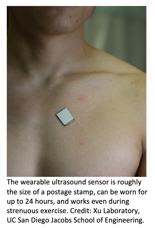 Wearable Ultrasound Device Images Heart Structure, Function for 24 Hours