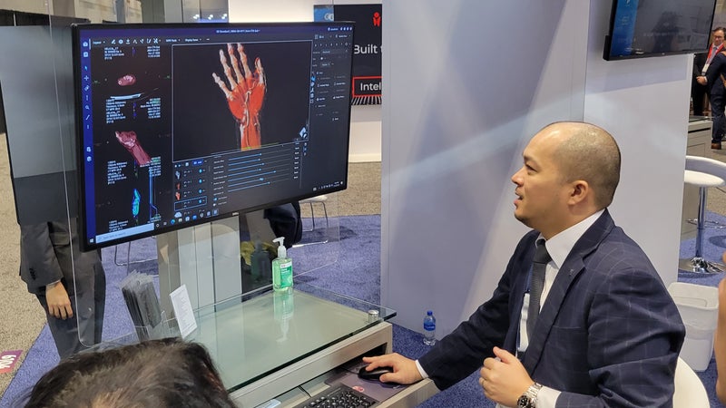 Ziosoft Simplifies Advanced Visualization Workflow with New Revoras Platform